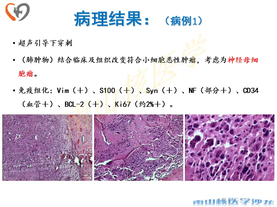 心肺听诊软件下载_心肺听诊的软件_福建医科大学心肺听诊软件 丁香园