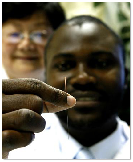 medical acupuncture_medical acupuncture_medical acupuncture