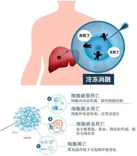 跑跑卡丁车漂移教程视频_跑跑卡丁车漂移拉车头_跑跑卡丁车漂移过头