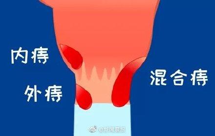 飘渺西游无限元宝服：爽翻天还是隐患多？